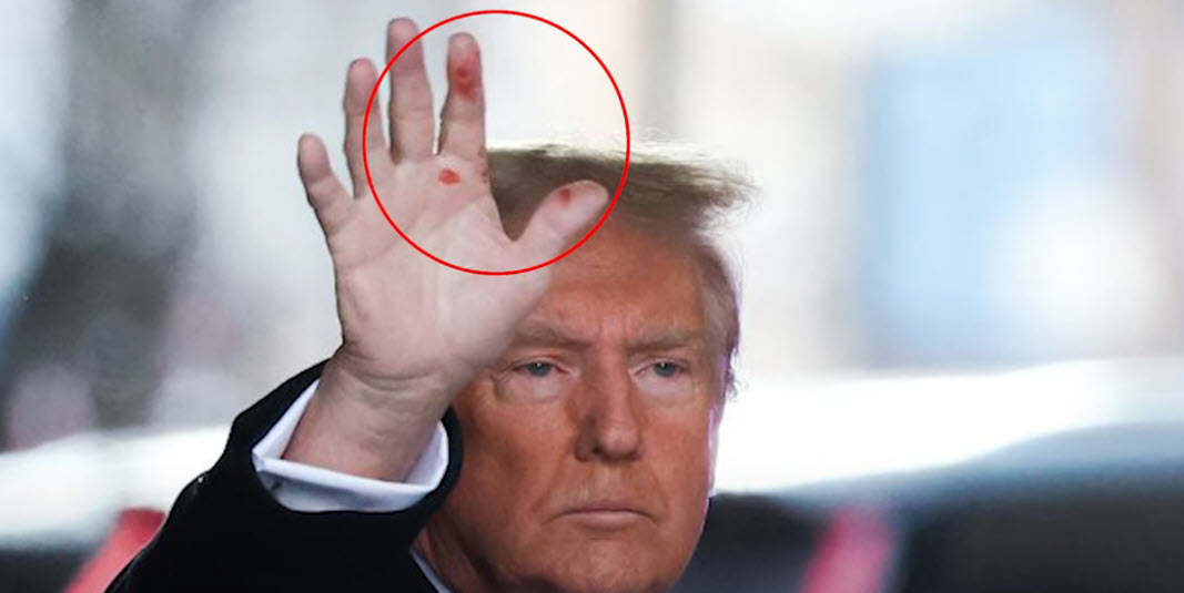 Trump Playfully Attributes Hand Marks to AI: Photos Spark Online Speculation