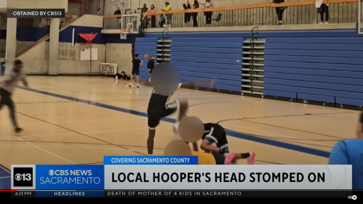 Sacramento Teen Suffers Concussion After Being Stomped On During Basketball Game